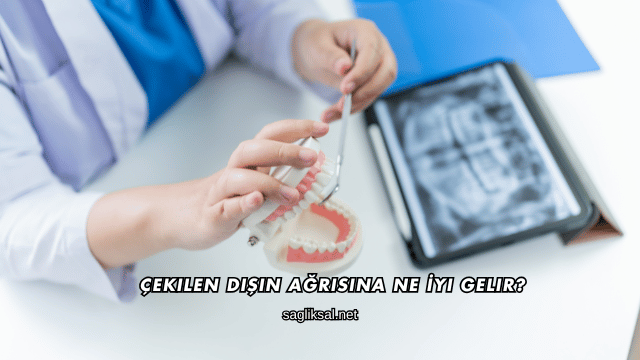 Çekilen Dişin Ağrısına Ne İyi Gelir?