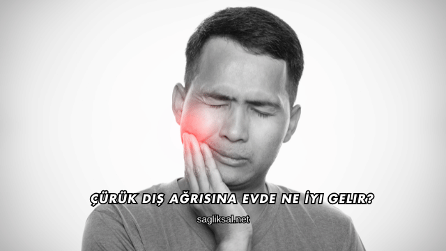 Çürük Diş Ağrısına Evde Ne İyi Gelir?