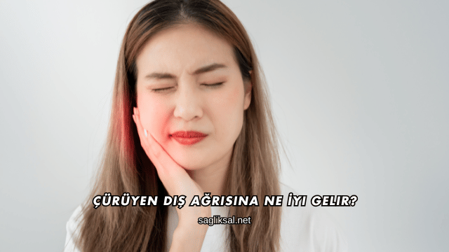 Çürüyen Diş Ağrısına Ne İyi Gelir?