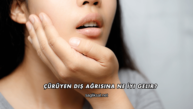 Çürüyen Diş Ağrısına Ne İyi Gelir?