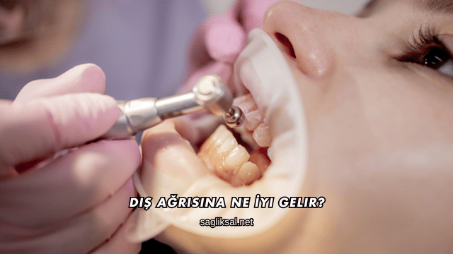 Diş Ağrısına Ne İyi Gelir?