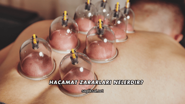 Hacamat Zararları Nelerdir?