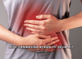 Mide Yanmasına Ayran İyi Gelir mi?